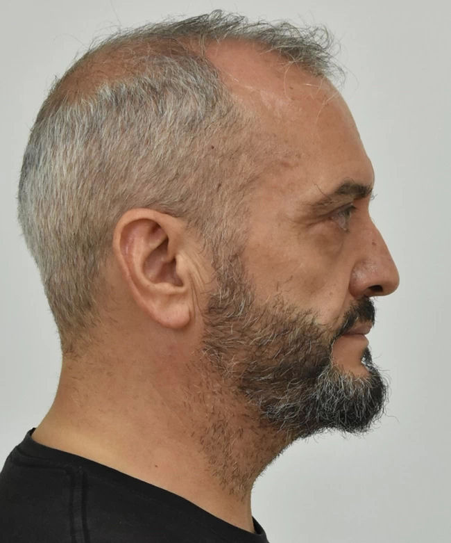 Mixos Ilias Paiderestis Biastis Agrinio 111022