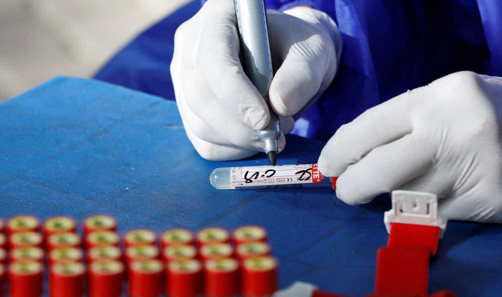 Virus test 020820